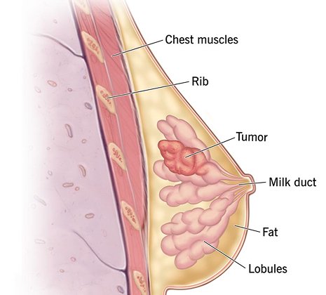 Breast & Reproductive Health Evaluation