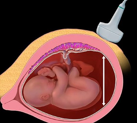 Fetal Growth & Well-being Scans